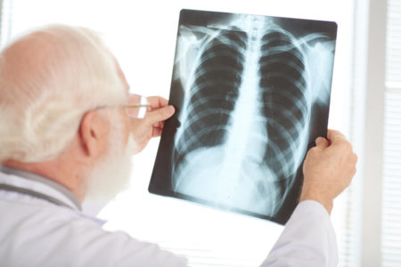 KAŠALJ, UMOR, OTEŽANO DISANJE…Udruženje za borbu protiv raka pluća poručuje: To su prvi simptomi da treba proveriti zdravlje